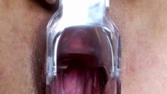 Cervix View And Pussy Gaping